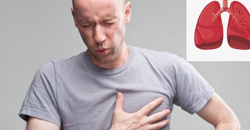 Chẩn đoán và điều trị tràn dịch màng phổi do lao