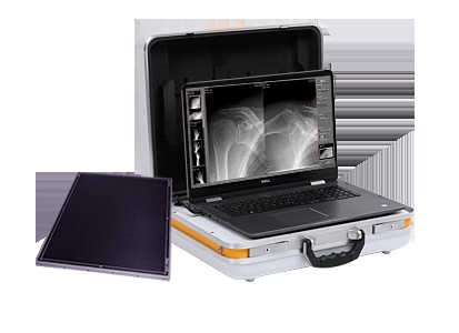 Bệnh viện Phổi Hải Dương cài đặt thành công máy in phim thông qua phần mềm CAD4TB với hệ thống máy X-Quang kỹ thuật số di động