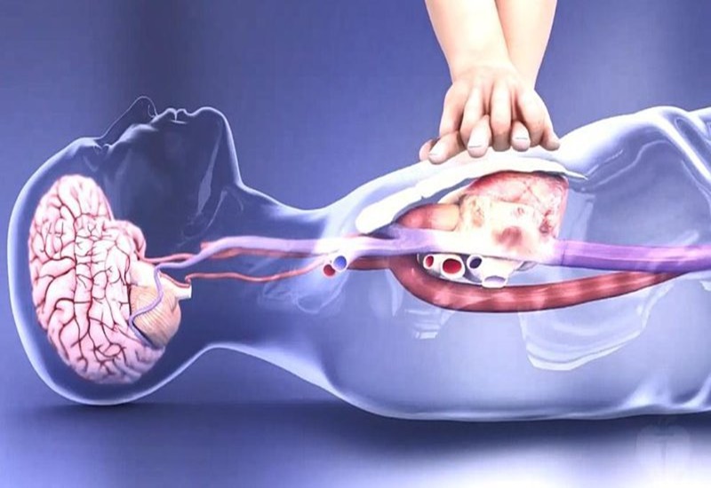 Bệnh viện Phổi Hải Dương tổ chức tập huấn  “Cấp cứu ngừng tuần hoàn cơ bản”  - đợt 2.